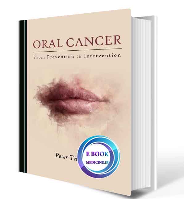 دانلود کتابOral Cancer From Prevention to Intervention2019(ORIGINAL PDF)